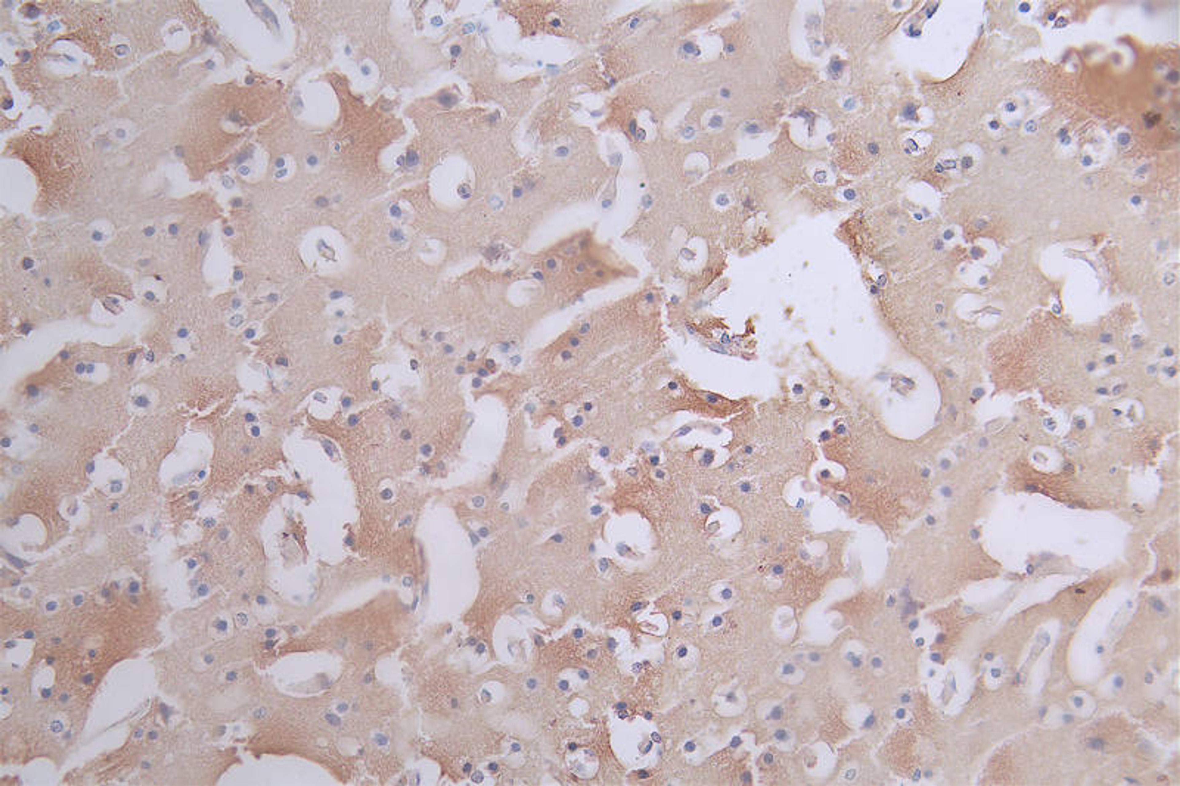 IHC image of CSB-RA901354A0HU diluted at 1:50 and staining in paraffin-embedded human brain tissue performed on a Leica BondTM system. After dewaxing and hydration, antigen retrieval was mediated by high pressure in a citrate buffer (pH 6.0). Section was blocked with 10% normal goat serum 30min at RT. Then primary antibody (1% BSA) was incubated at 4°C overnight. The primary is detected by a Goat anti-rabbit polymer IgG labeled by HRP and visualized using 0.11% DAB.