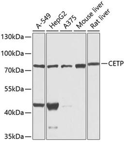 Western blot - CETP antibody (A1355)