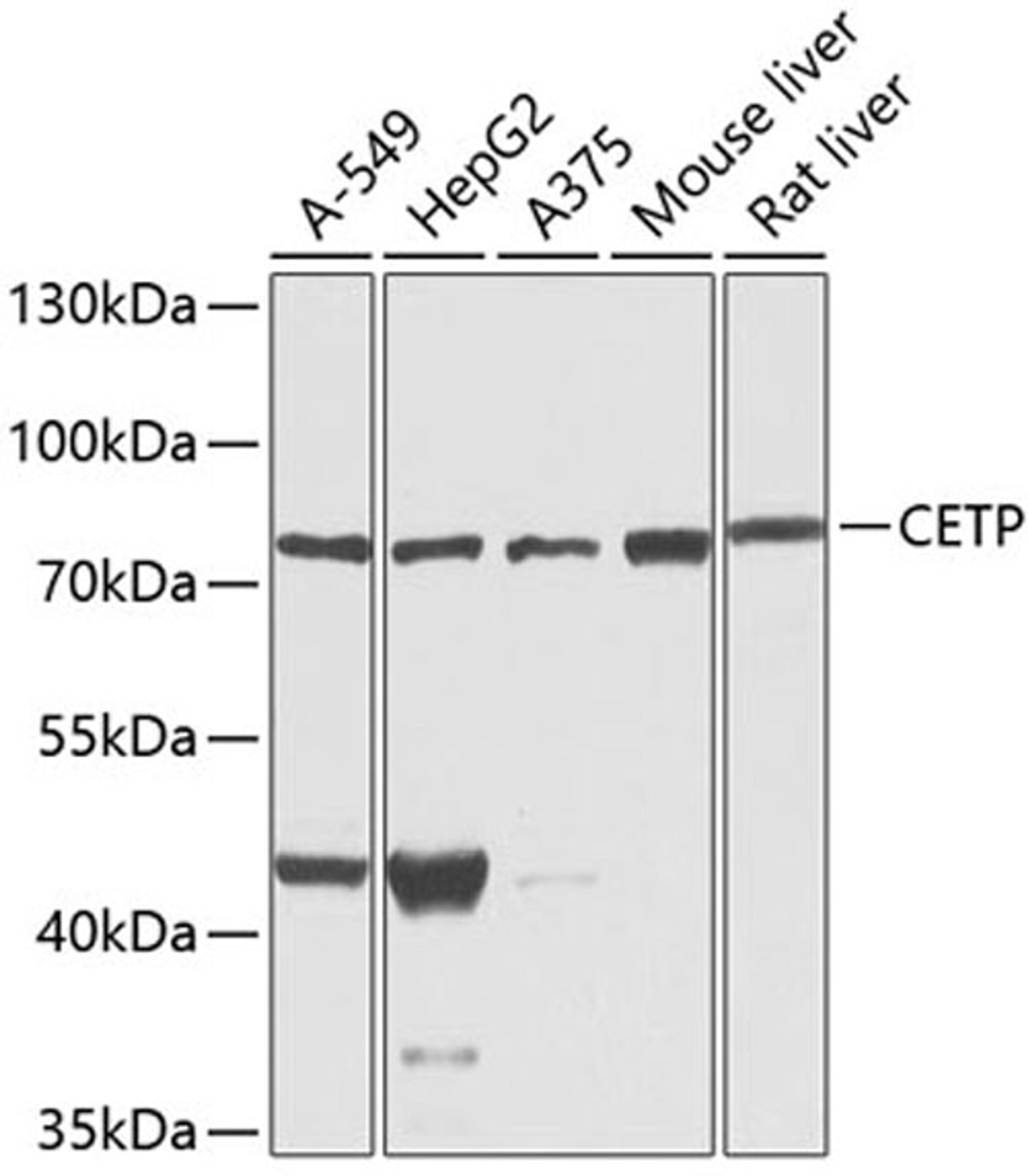 Western blot - CETP antibody (A1355)