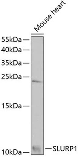 Western blot - SLURP1 antibody (A7123)