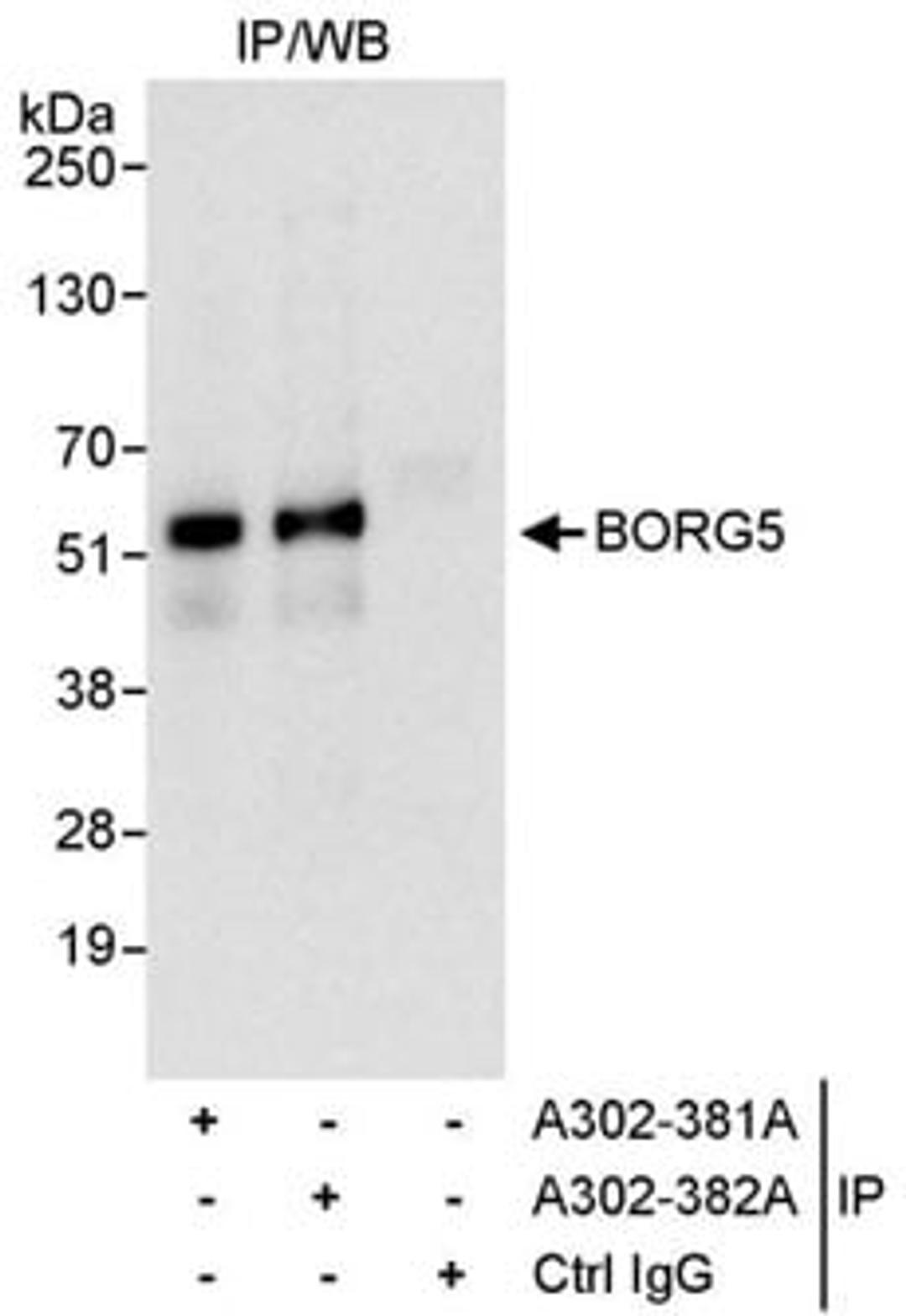 Detection of human BORG5 by western blot of immunoprecipitates.