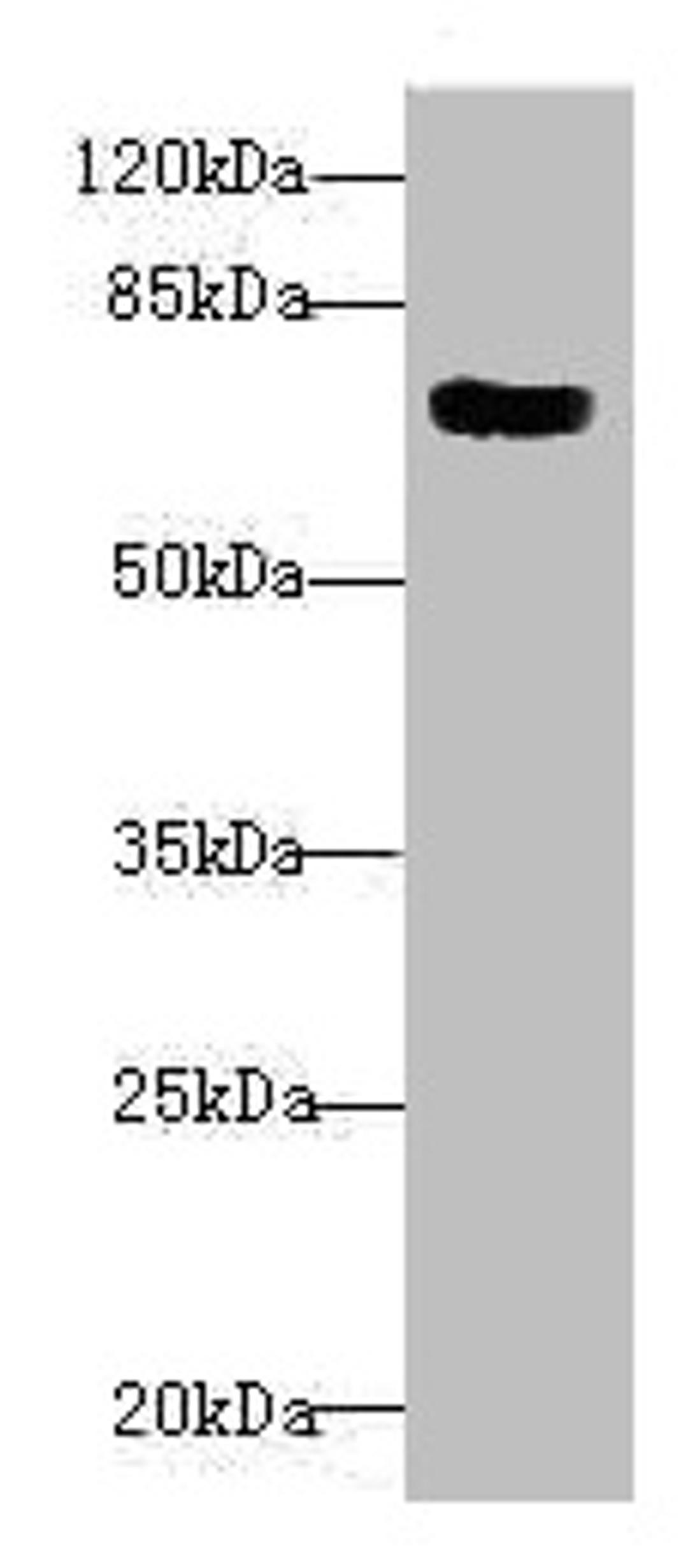 Western blot. All lanes: CBFA2T2 antibody at 1.82µg/ml + 293T whole cell lysate. Secondary. Goat polyclonal to rabbit IgG at 1/10000 dilution. Predicted band size: 68, 64, 29, 66 kDa. Observed band size: 68 kDa