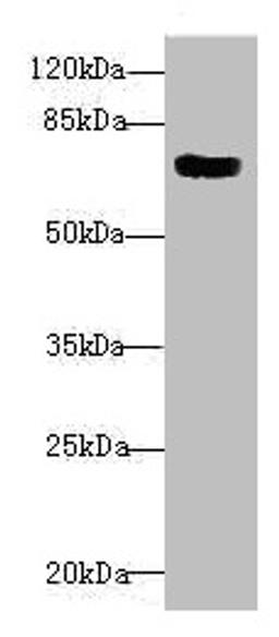 Western blot. All lanes: CBFA2T2 antibody at 1.82µg/ml + 293T whole cell lysate. Secondary. Goat polyclonal to rabbit IgG at 1/10000 dilution. Predicted band size: 68, 64, 29, 66 kDa. Observed band size: 68 kDa