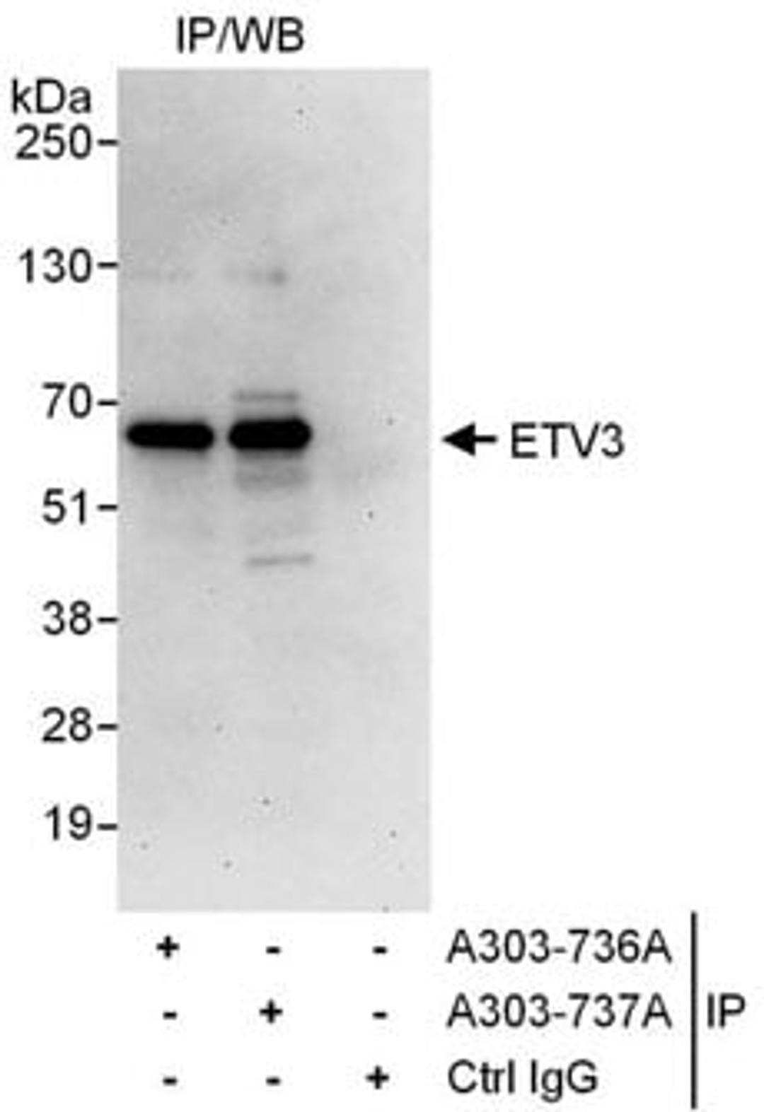 Detection of human ETV3 by western blot of immunoprecipitates.