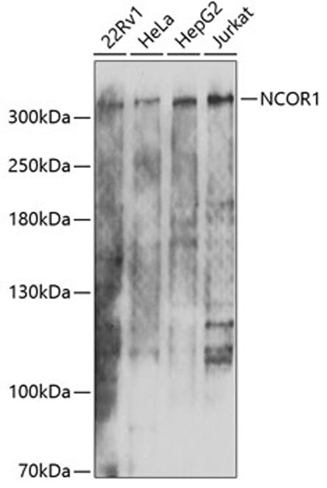 Western blot - NCOR1 antibody (A7046)