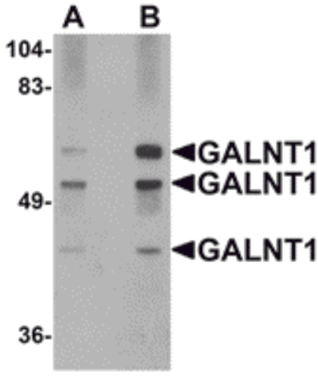 Western blot analysis of GALNT10 in rat brain tissue lysate with GALNT10 antibody at (A) 1 and (B) 2 &#956;g/mL.