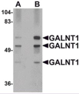 Western blot analysis of GALNT10 in rat brain tissue lysate with GALNT10 antibody at (A) 1 and (B) 2 &#956;g/mL.