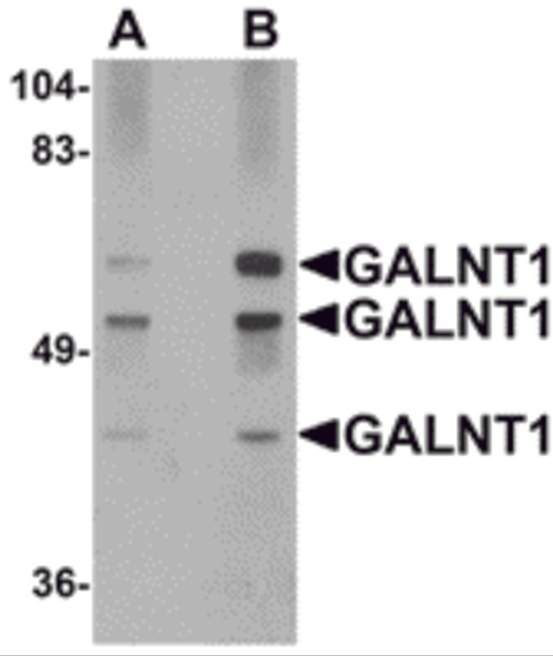 Western blot analysis of GALNT10 in rat brain tissue lysate with GALNT10 antibody at (A) 1 and (B) 2 μg/mL.