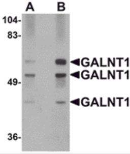 Western blot analysis of GALNT10 in rat brain tissue lysate with GALNT10 antibody at (A) 1 and (B) 2 μg/mL.