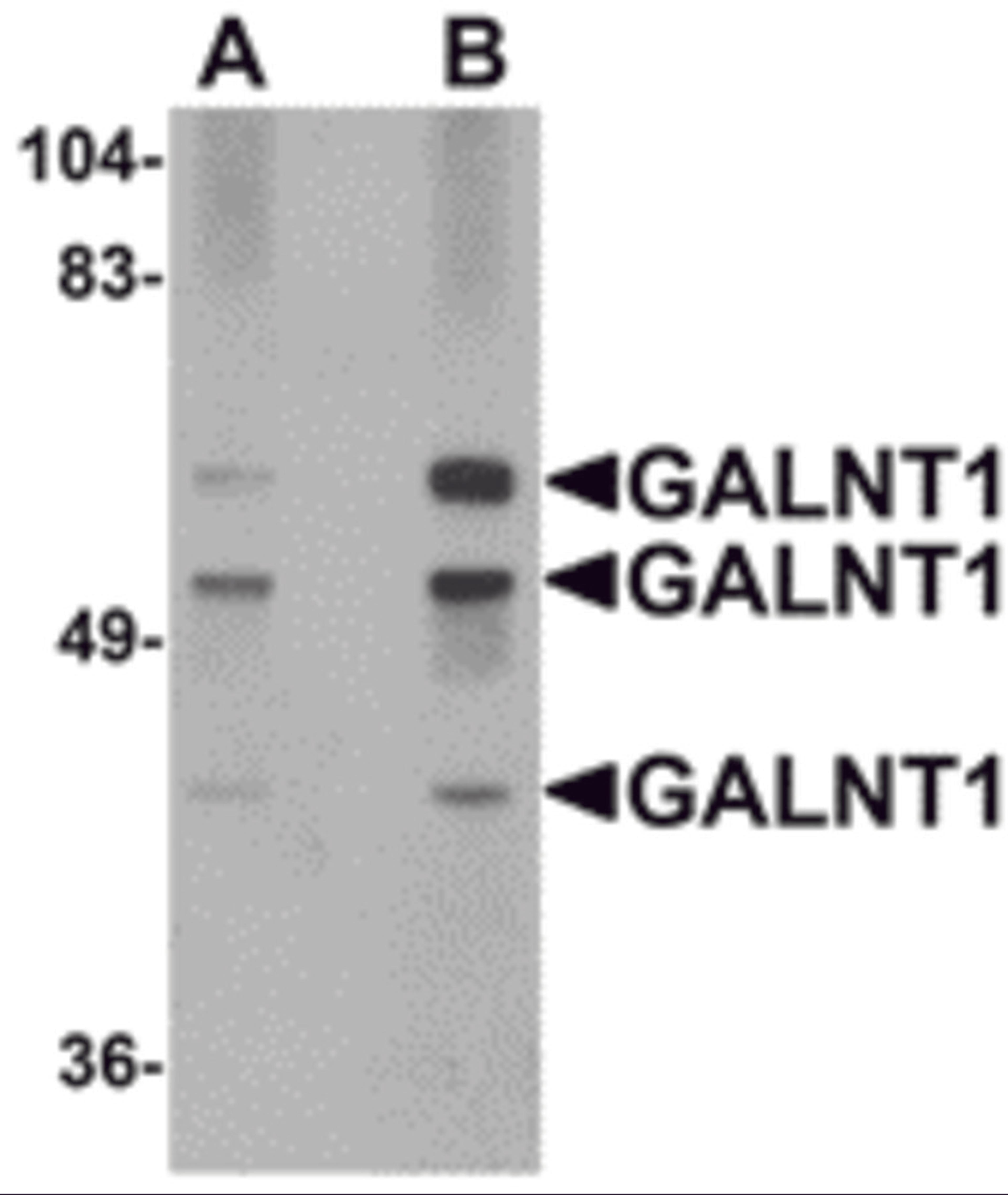 Western blot analysis of GALNT10 in rat brain tissue lysate with GALNT10 antibody at (A) 1 and (B) 2 μg/mL.