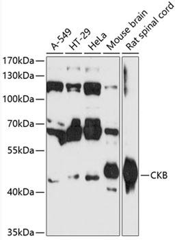 Western blot - CKB antibody (A12631)