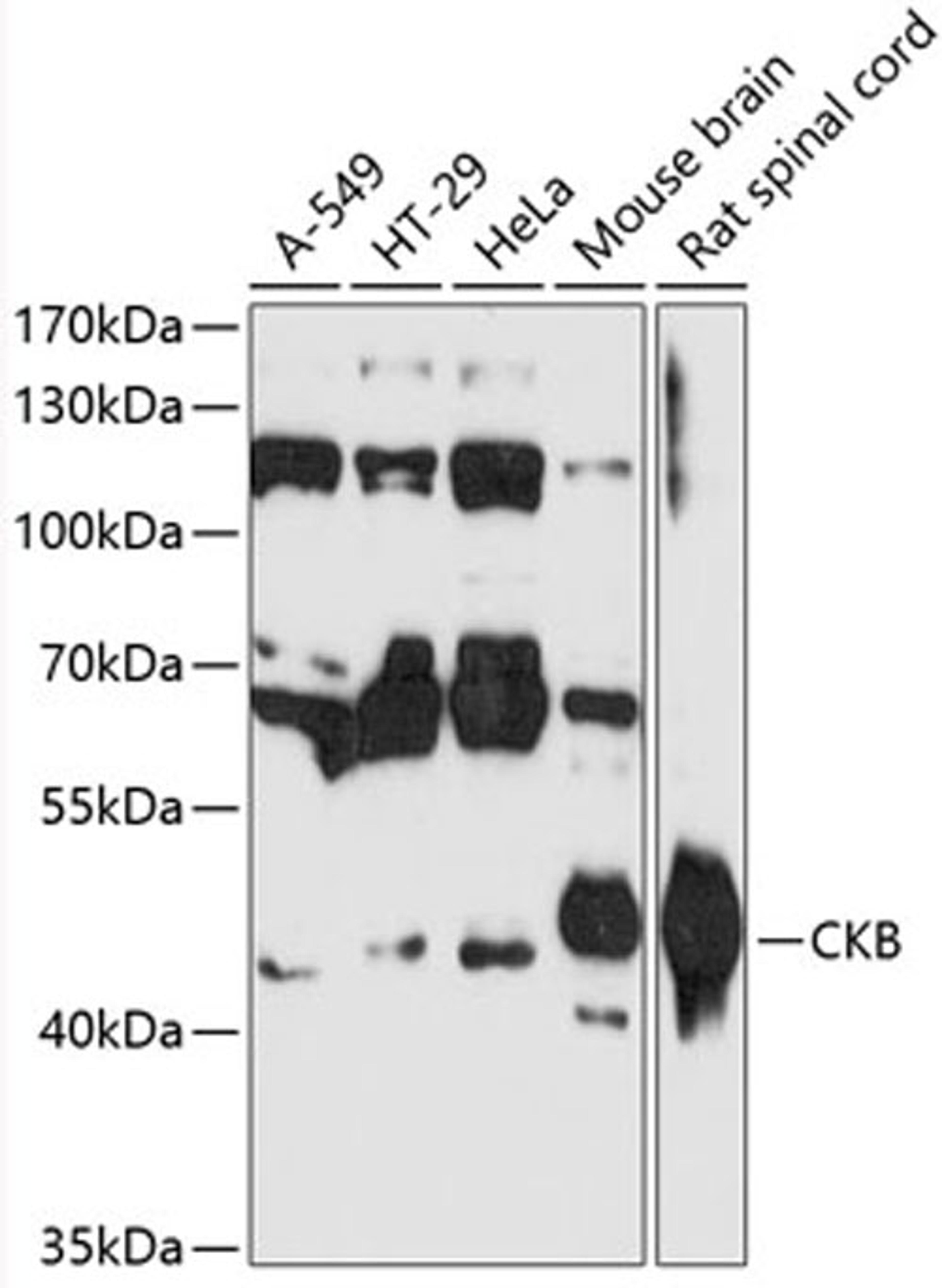 Western blot - CKB antibody (A12631)