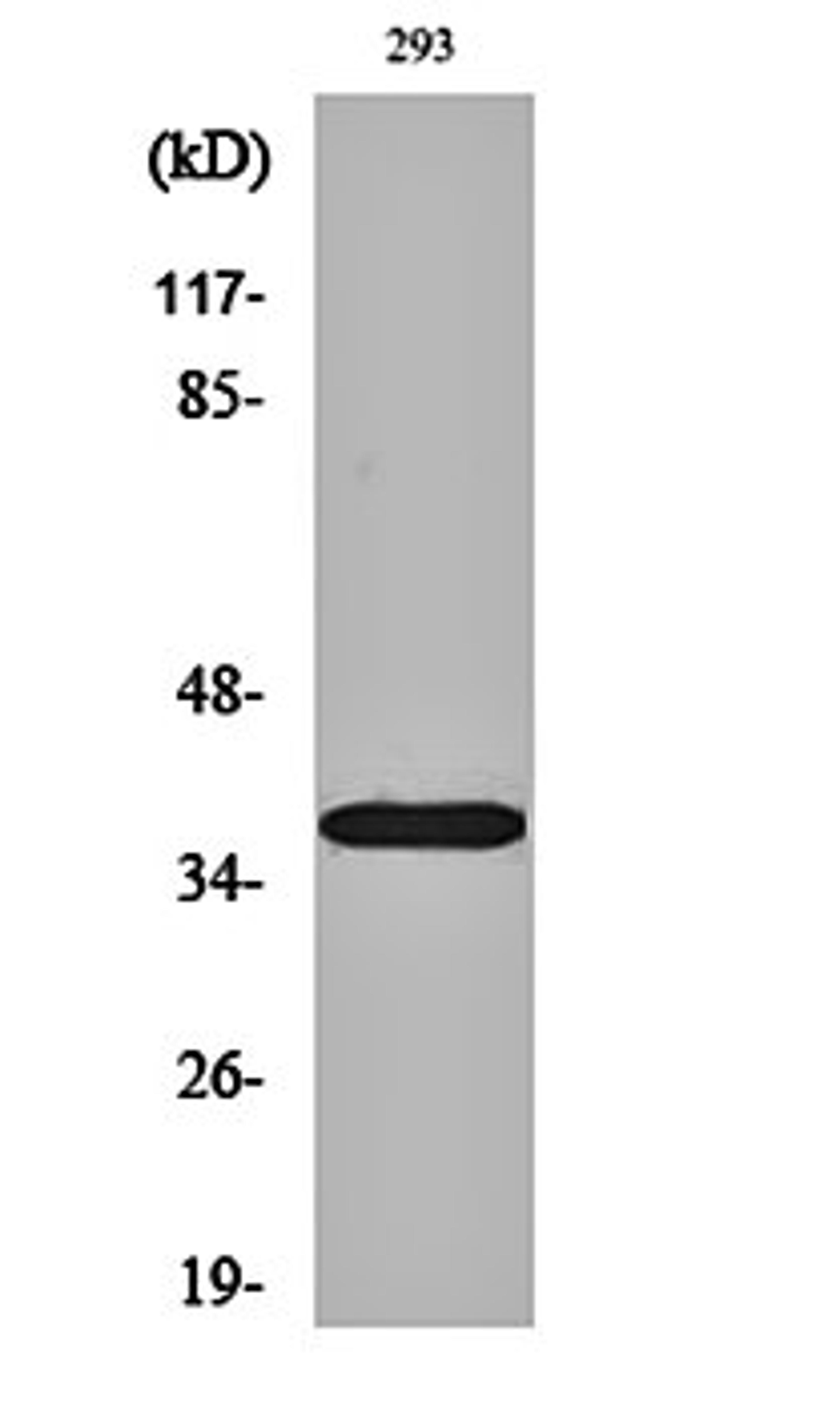 Western blot analysis of 293 cell lysates using 17 beta -HSD11 antibody