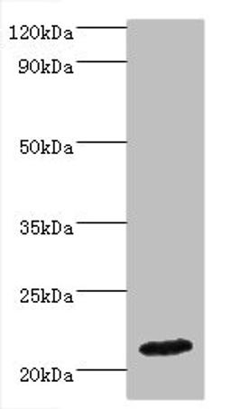 Western blot. All lanes: IFNA4 antibody at 2µg/ml + Mouse kidney tissue. Secondary. Goat polyclonal to rabbit IgG at 1/10000 dilution. Predicted band size: 22 kDa. Observed band size: 22 kDa