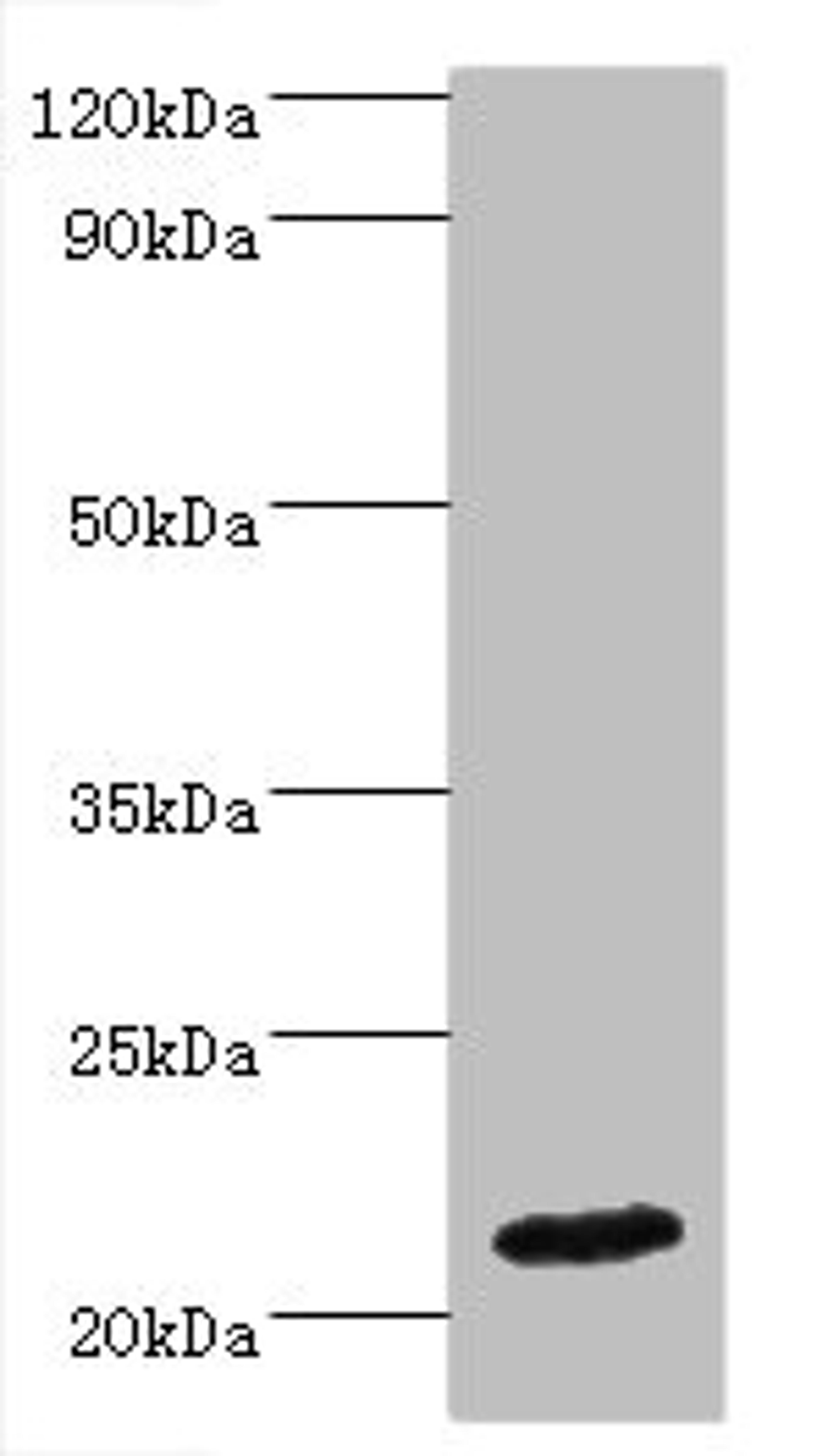 Western blot. All lanes: IFNA4 antibody at 2µg/ml + Mouse kidney tissue. Secondary. Goat polyclonal to rabbit IgG at 1/10000 dilution. Predicted band size: 22 kDa. Observed band size: 22 kDa