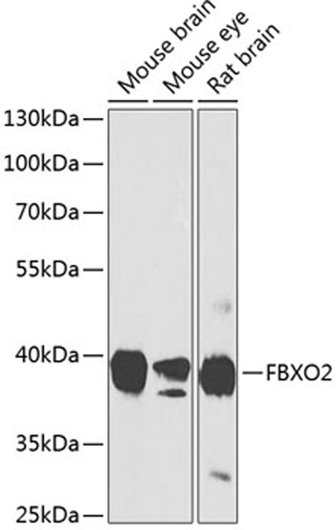 Western blot - FBXO2 antibody (A8579)