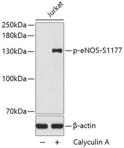 Western blot - Phospho-eNOS-S1177 antibody (AP0421)