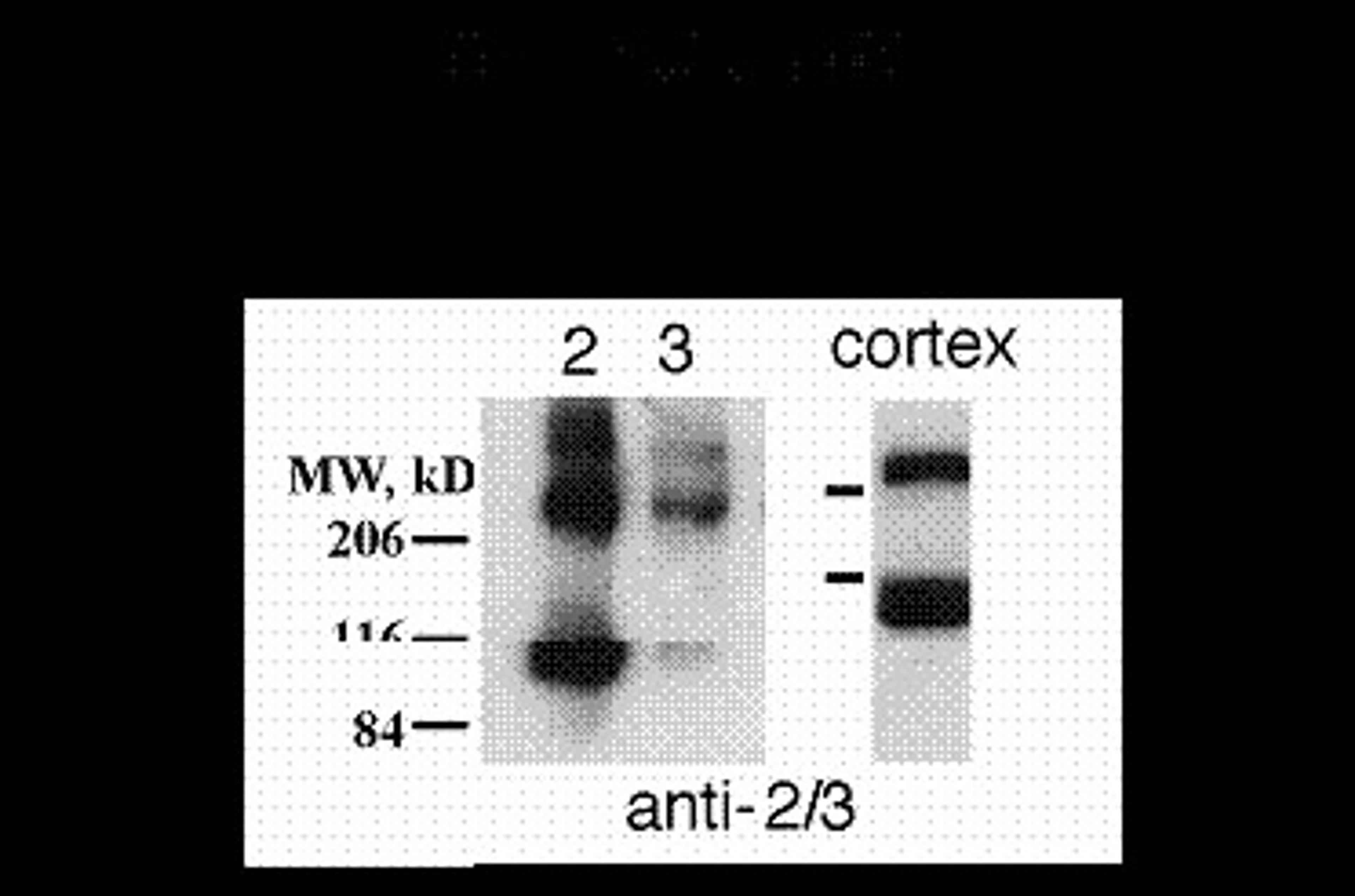 Metabotropic Glutamate Receptor 2/3 Antibody