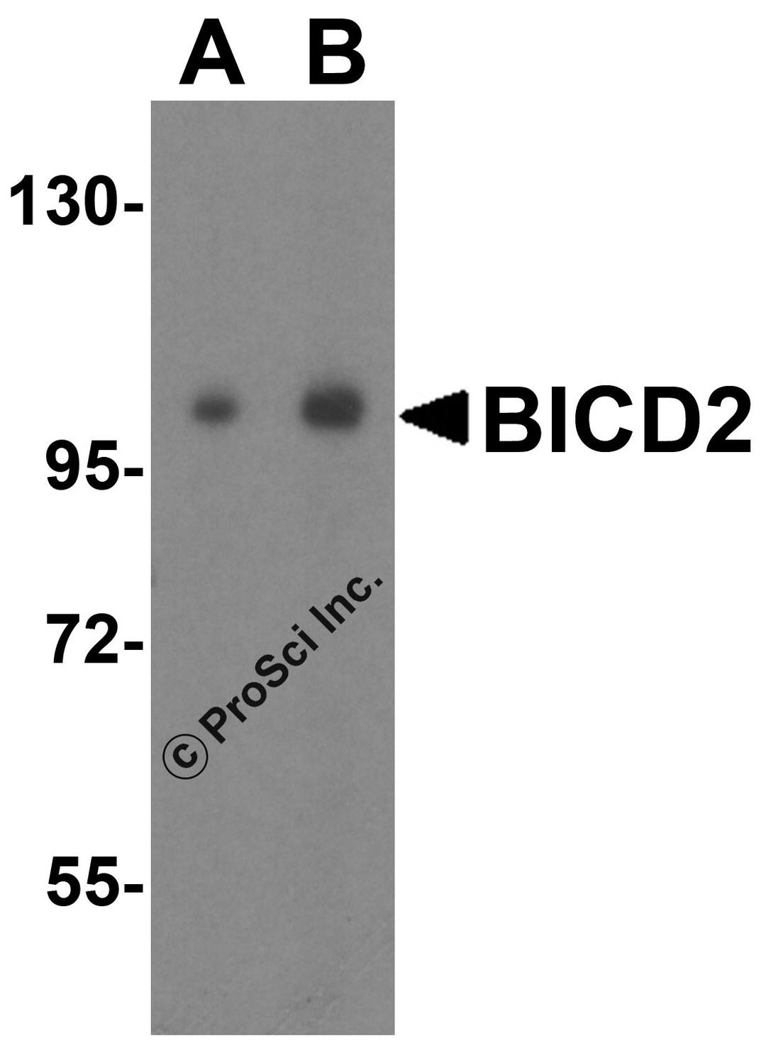 Western blot analysis of BICD2 in 293 cell lysate with BICD2 antibody at (A) 1 and (B) 2 &#956;g/mL.