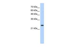 Antibody used in WB on Transfected 293T at 1.25 ug/ml.