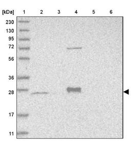 Western Blot: MRPS15 Antibody [NBP1-82319] - Lane 1: Marker [kDa] 230, 130, 95, 72, 56, 36, 28, 17, 11<br/>Lane 2: Human cell line RT-4<br/>Lane 3: Human cell line U-251MG sp<br/>Lane 4: Human plasma (IgG/HSA depleted)<br/>Lane 5: Human liver tissue<br/>Lane 6: Human tonsil tissue