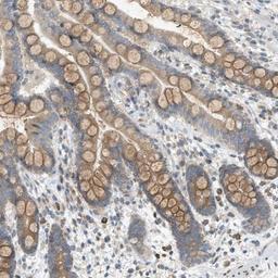 Immunohistochemistry-Paraffin: DYRK1A Antibody [NBP1-84031] - Staining of human colon shows cytoplasmic positivity in glandular cells.