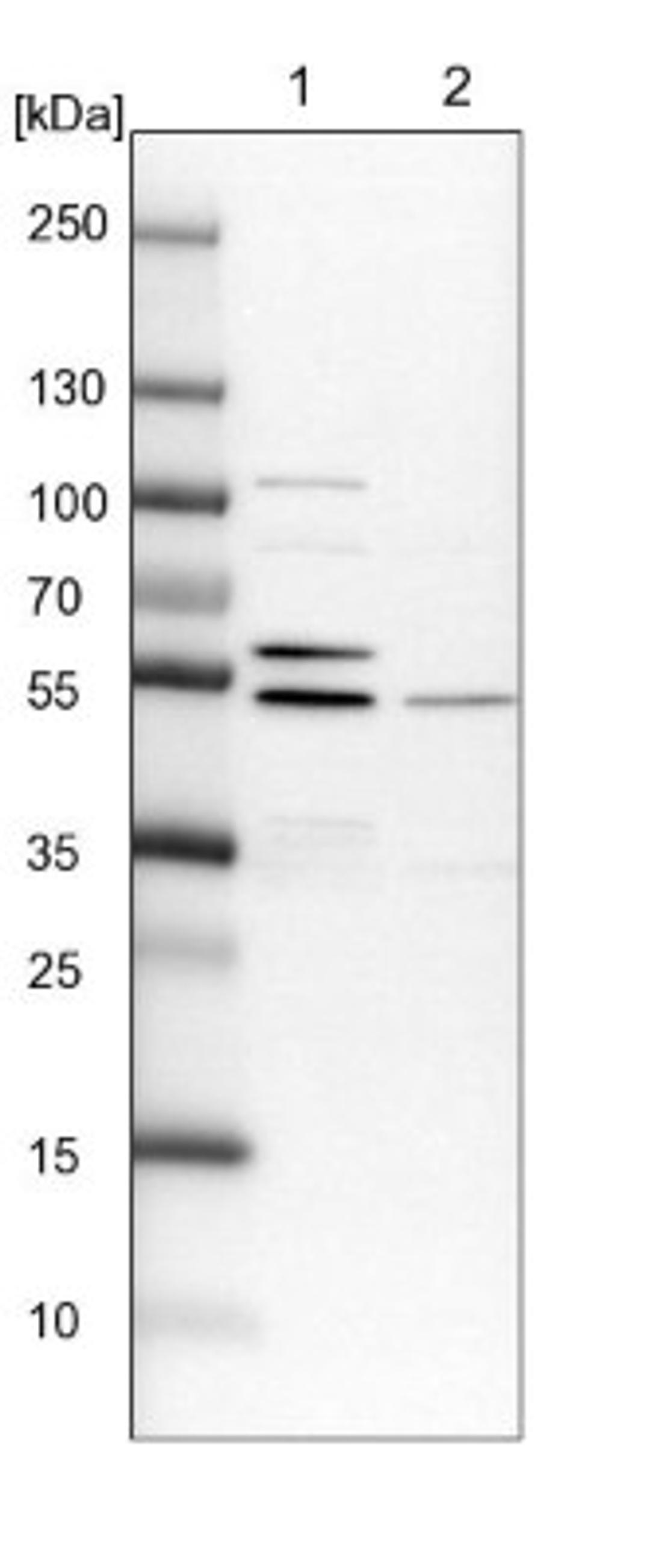 Western Blot: LYPLA3 Antibody [NBP1-92088] - Lane 1: NIH-3T3 cell lysate (Mouse embryonic fibroblast cells)<br/>Lane 2: NBT-II cell lysate (Rat Wistar bladder tumour cells)