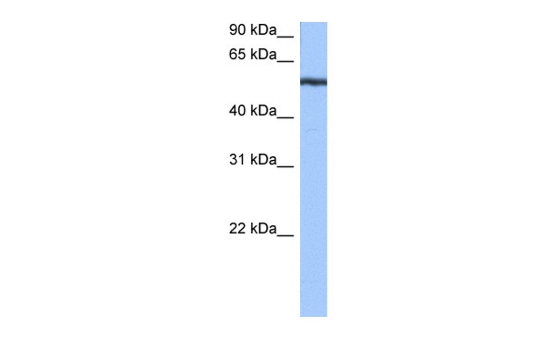 Antibody used in WB on Human Jurkat 0.2-1 ug/ml.