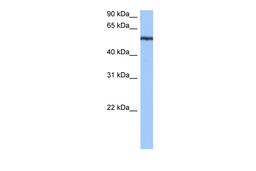 Antibody used in WB on Human Jurkat 0.2-1 ug/ml.