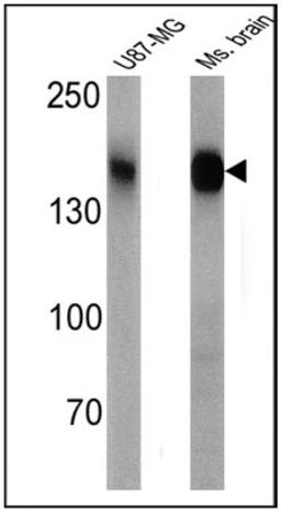 Western Blot: CACNA2D1 Antibody (20A) [NB120-2864] - Analysis of 25 ug of U87-MG (lane 1) and mouse brain (lane 2) cell lysates.