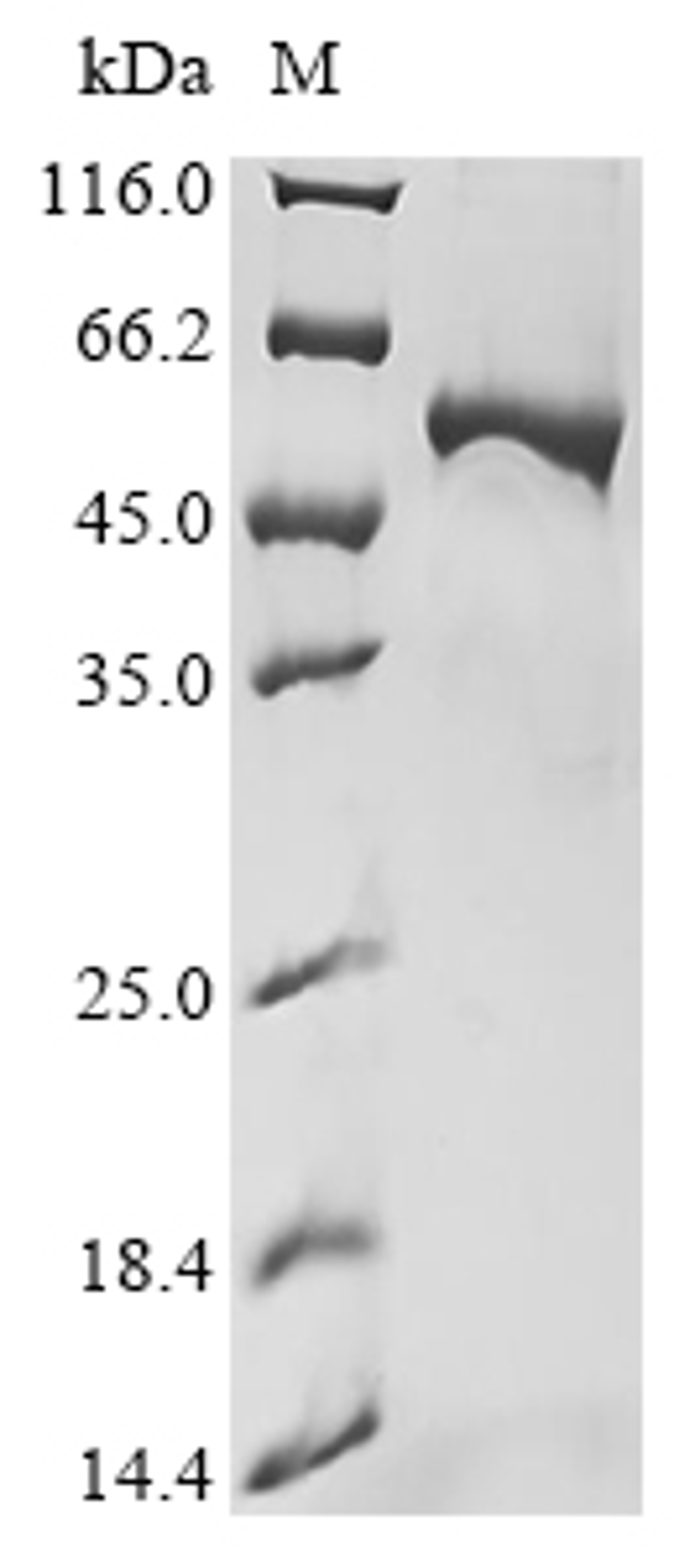 (Tris-Glycine gel) Discontinuous SDS-PAGE (reduced) with 5% enrichment gel and 15% separation gel.