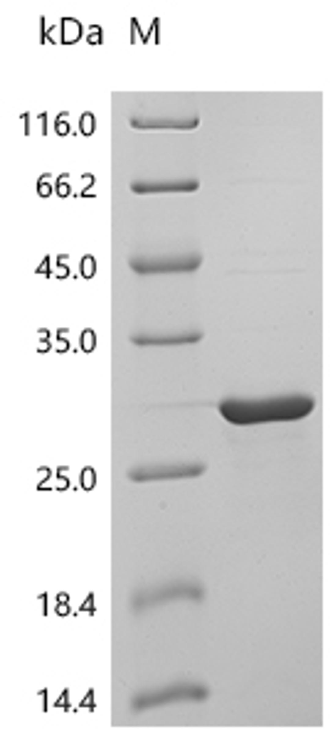 (Tris-Glycine gel) Discontinuous SDS-PAGE (reduced) with 5% enrichment gel and 15% separation gel.