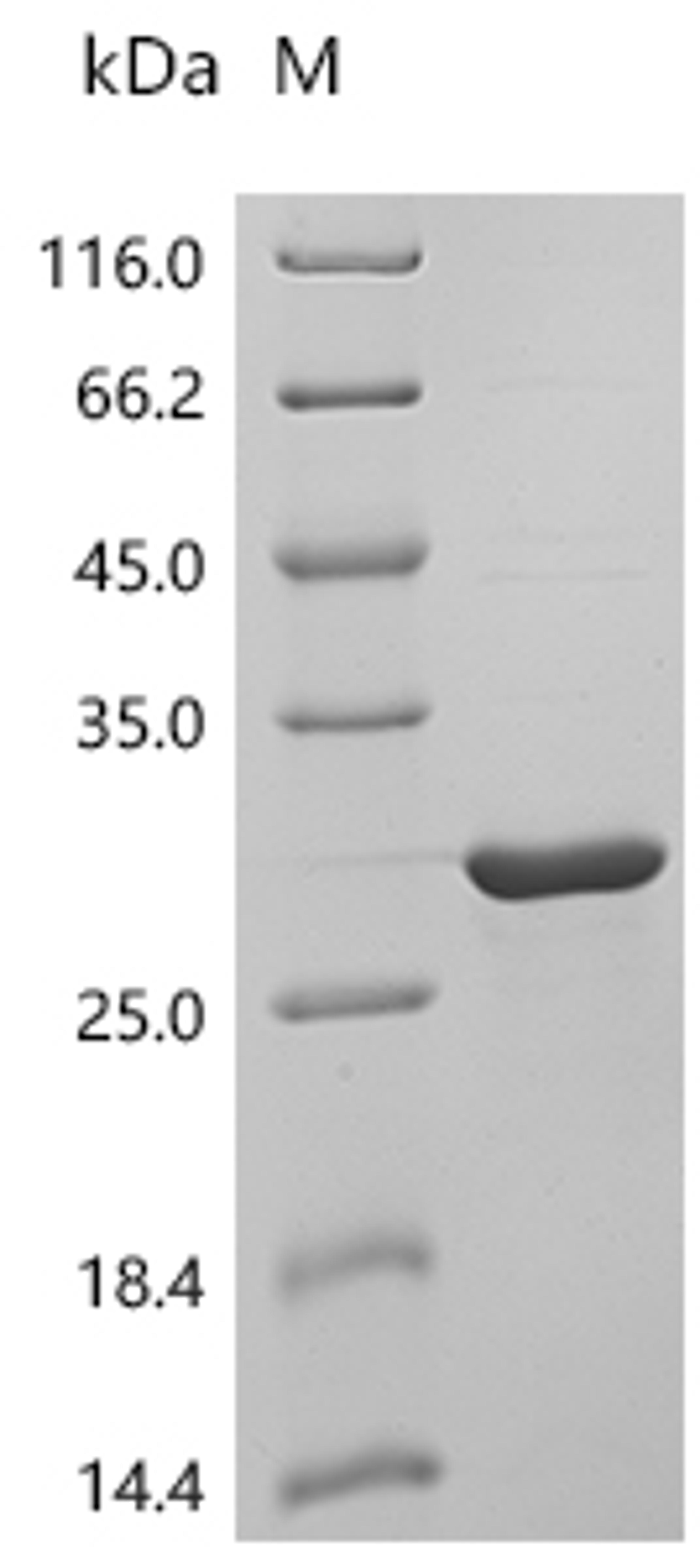 (Tris-Glycine gel) Discontinuous SDS-PAGE (reduced) with 5% enrichment gel and 15% separation gel.