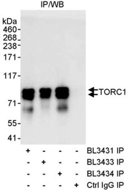 Detection of human TORC1 by western blot of immunoprecipitates.