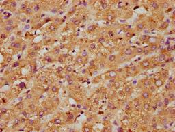 IHC image of CSB-PA06899A0Rb diluted at 1:600 and staining in paraffin-embedded human liver tissue performed on a Leica BondTM system. After dewaxing and hydration, antigen retrieval was mediated by high pressure in a citrate buffer (pH 6.0). Section was blocked with 10% normal goat serum 30min at RT. Then primary antibody (1% BSA) was incubated at 4°C overnight. The primary is detected by a biotinylated secondary antibody and visualized using an HRP conjugated SP system.