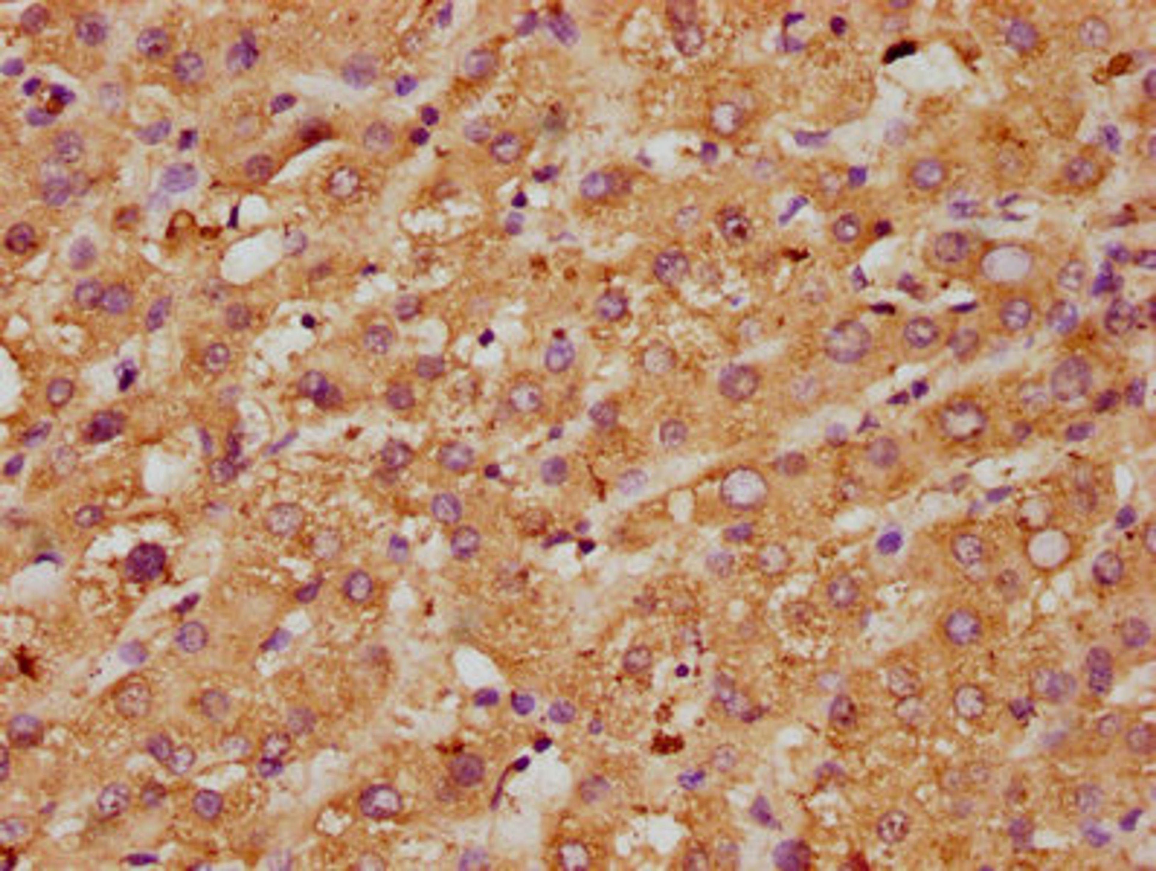 IHC image of CSB-PA06899A0Rb diluted at 1:600 and staining in paraffin-embedded human liver tissue performed on a Leica BondTM system. After dewaxing and hydration, antigen retrieval was mediated by high pressure in a citrate buffer (pH 6.0). Section was blocked with 10% normal goat serum 30min at RT. Then primary antibody (1% BSA) was incubated at 4°C overnight. The primary is detected by a biotinylated secondary antibody and visualized using an HRP conjugated SP system.