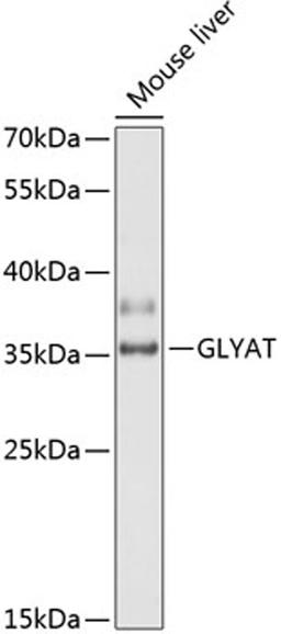 Western blot - GLYAT antibody (A14100)