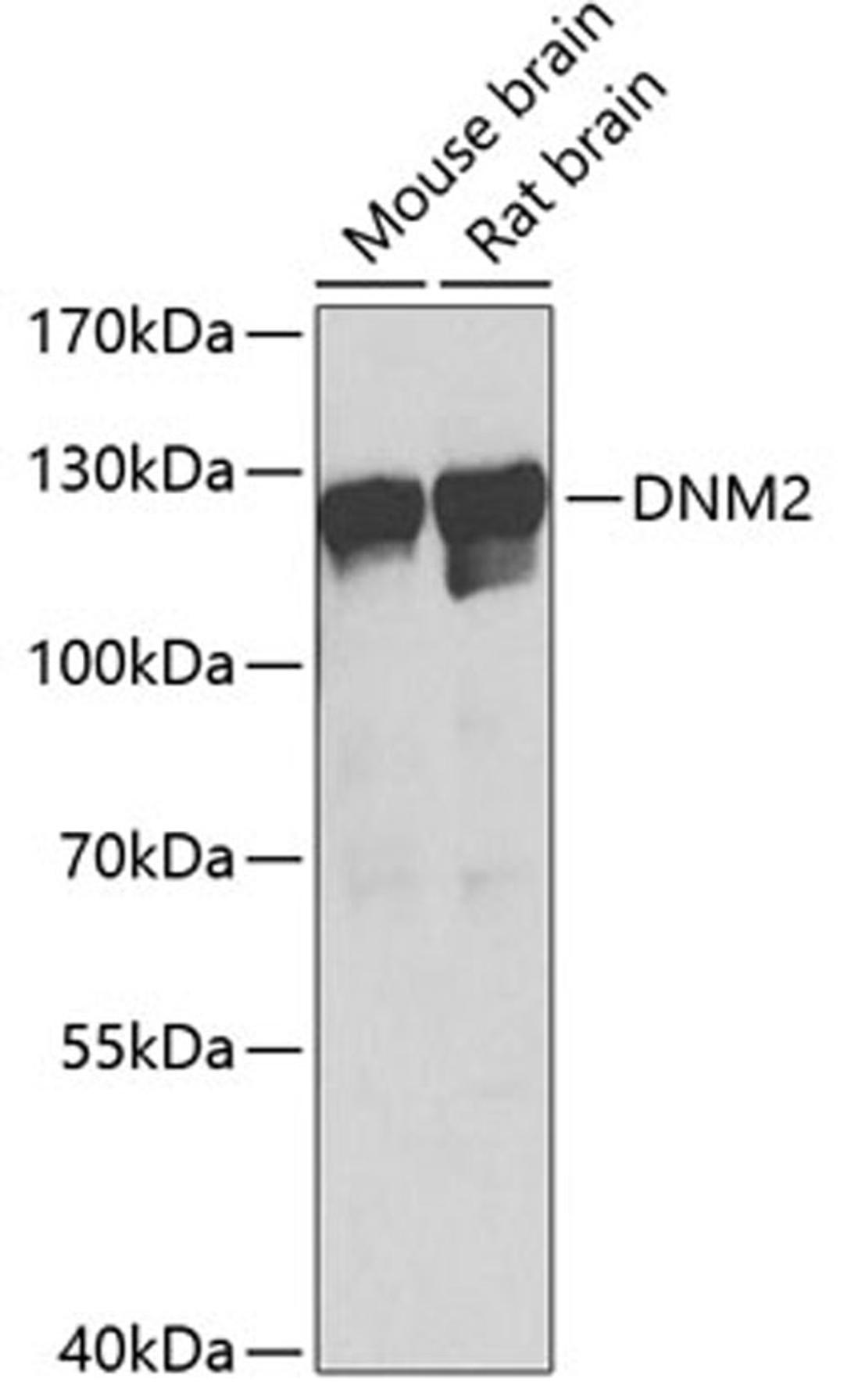 Western blot - DNM2 Antibody (A7890)