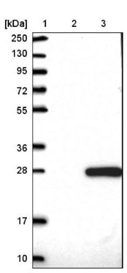 Western Blot: FAM96A Antibody [NBP1-82100] - Lane 1: Marker [kDa] 250, 130, 95, 72, 55, 36, 28, 17, 10<br/>Lane 2: Negative control (vector only transfected HEK293T lysate)<br/>Lane 3: Over-expression lysate (Co-expressed with a C-terminal myc-DDK tag (~3.1 kDa) in mammalian HEK293T cells, LY410258)