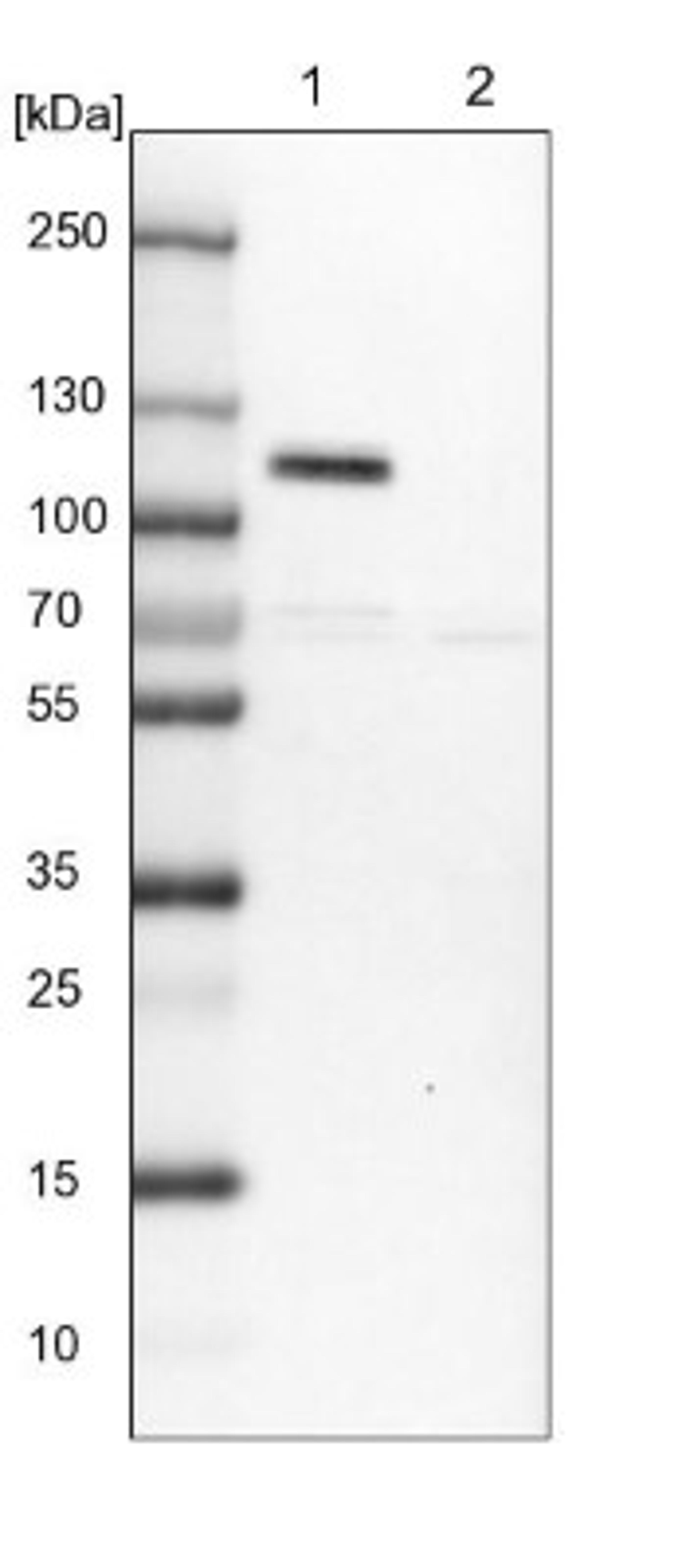 Western Blot: DOC1 Antibody [NBP1-84064] - Lane 1: NIH-3T3 cell lysate (Mouse embryonic fibroblast cells)<br/>Lane 2: NBT-II cell lysate (Rat Wistar bladder tumour cells)