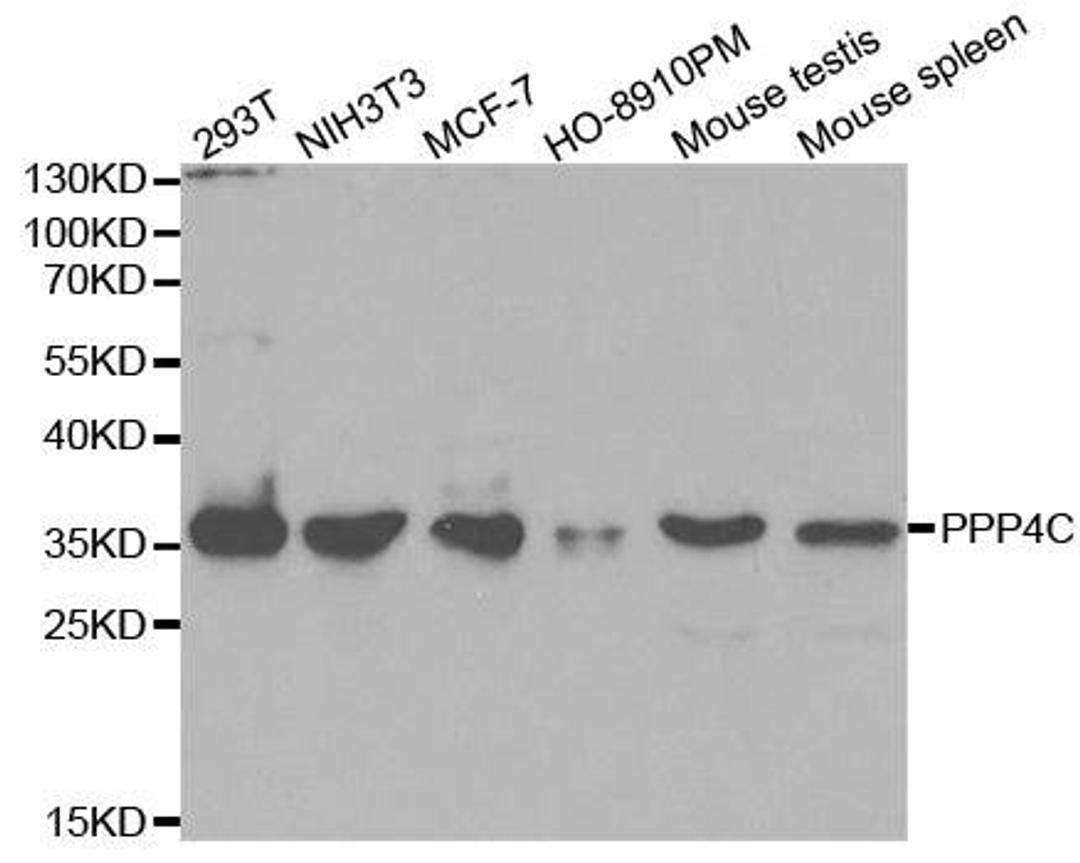 Western blot analysis of extracts of various cell lines using PPP4C antibody