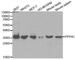 Western blot analysis of extracts of various cell lines using PPP4C antibody