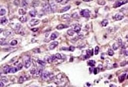 Immunohistochemical analysis of formalin-fixed paraffin embedded human laryngeal tissue using Kv1.3 antibody (dilution at 1:200)