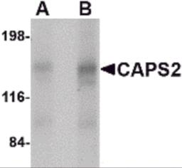 Western blot analysis of CAPS2 in human brain tissue lysate with CAPS2 antibody at (A) 0.5 and (B) 1 &#956;g/mL.