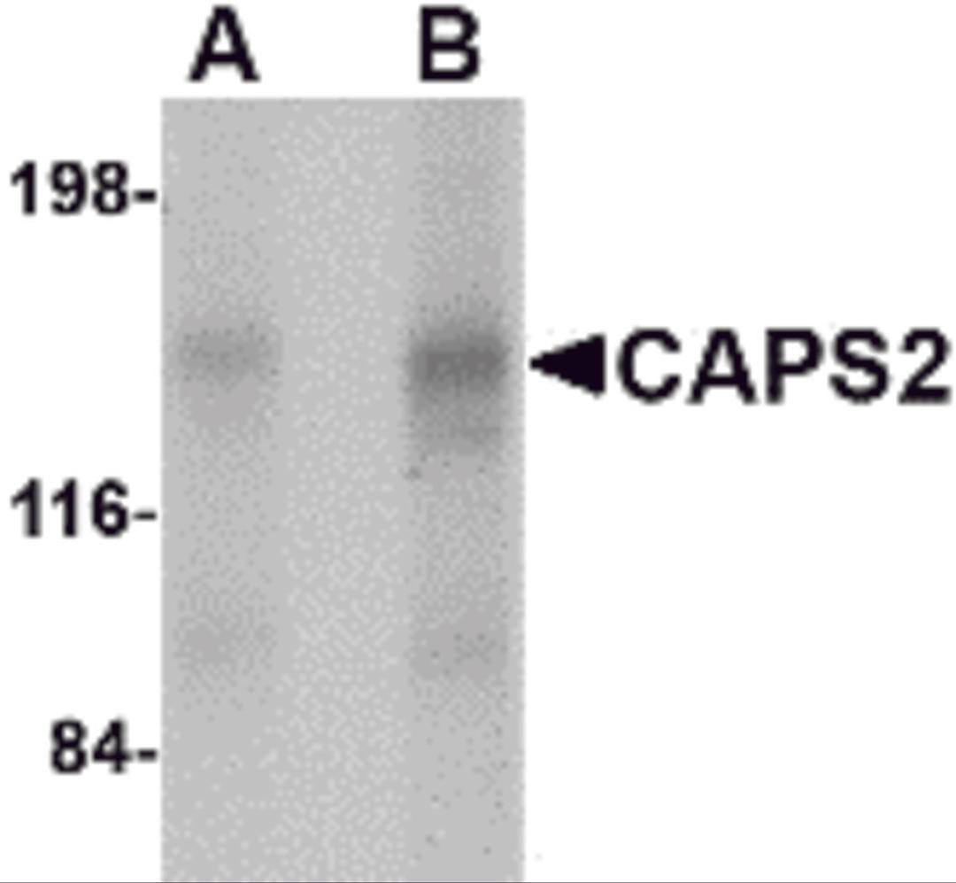 Western blot analysis of CAPS2 in human brain tissue lysate with CAPS2 antibody at (A) 0.5 and (B) 1 μg/mL.