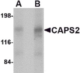 Western blot analysis of CAPS2 in human brain tissue lysate with CAPS2 antibody at (A) 0.5 and (B) 1 μg/mL.