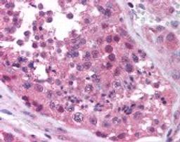 Immunohistochemistry staining of MAGEA4 in testis (formalin-fixed paraffin embedded) tissue using MAGEA4 Antibody.