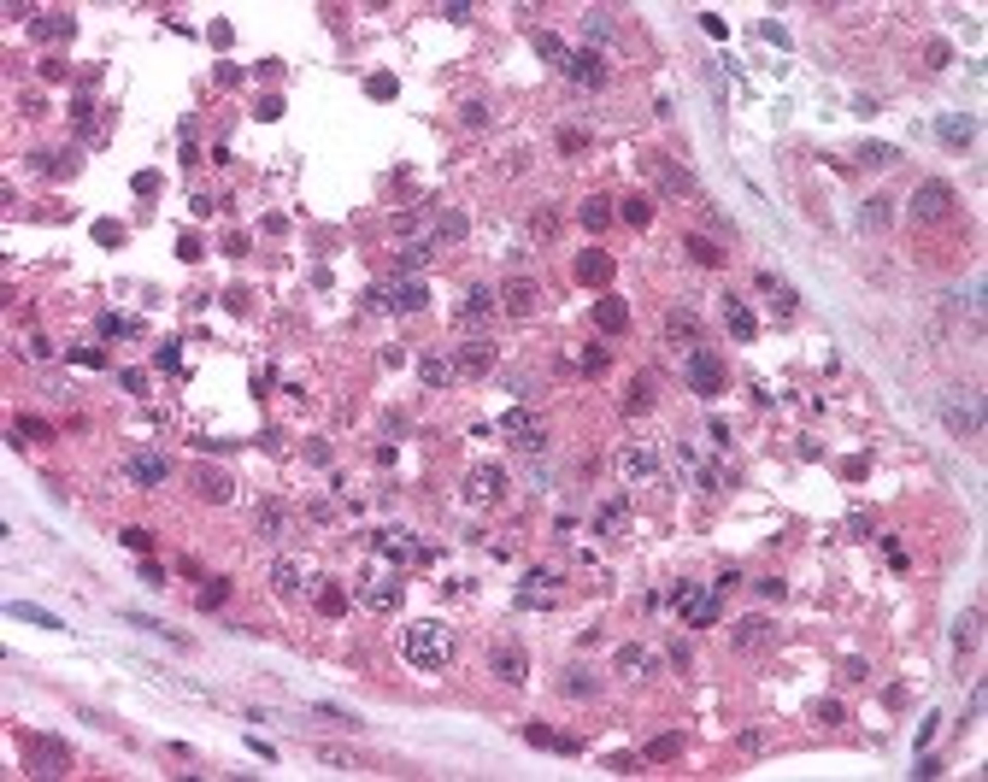 Immunohistochemistry staining of MAGEA4 in testis (formalin-fixed paraffin embedded) tissue using MAGEA4 Antibody.