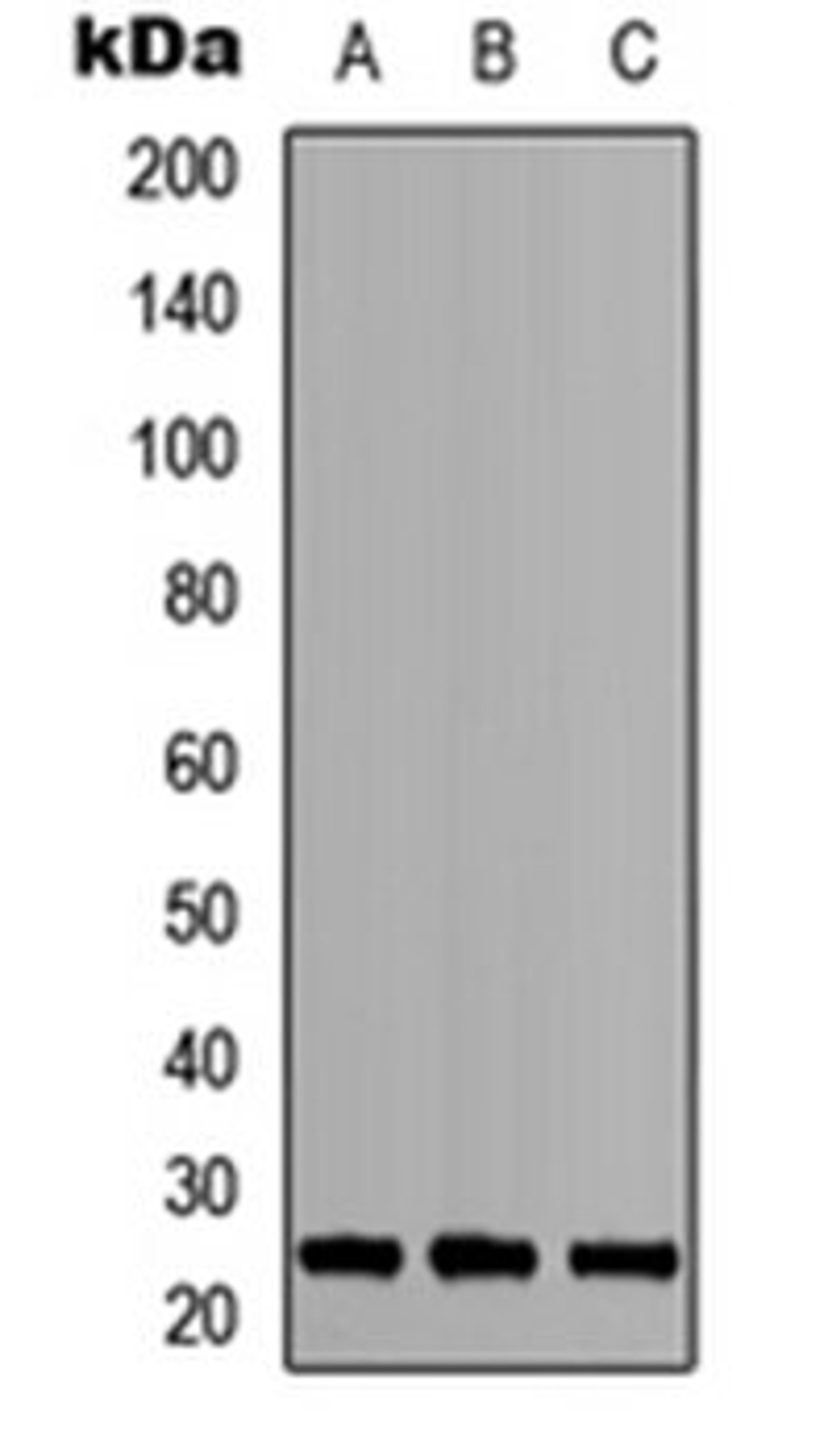 Western blot analysis of HEK293T (Lane 1), NS-1 (Lane 2), PC12 (Lane 3) whole cell lysates using MOB3A/B antibody