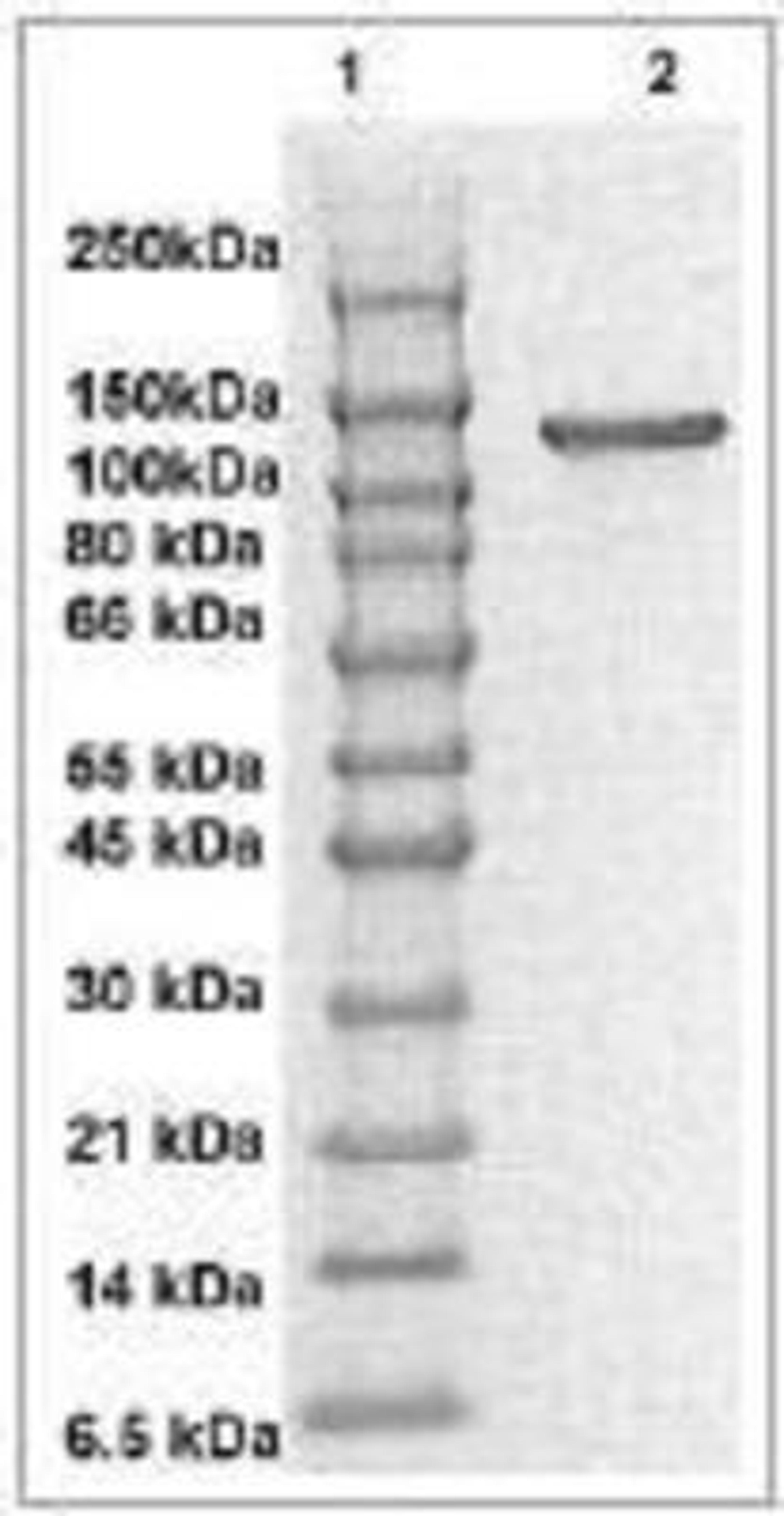 Western Blot: FAK Antibody [NBP1-72238] - The cell lysate derived from pervanadate treated 3T3 was resolved onto 7.5% SDSPAGE, transferred onto NC membrane, and followed by an immunoblotting with Rabbit anti FAK (pY576) antibody at 1:500